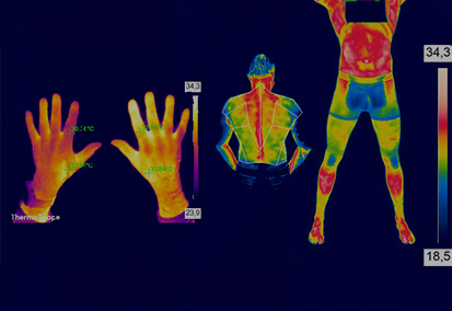 Thermografie-Aufnahmen von Händen, Rücken und Körper